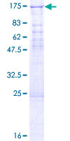 12.5% SDS-PAGE Stained with Coomassie Blue.